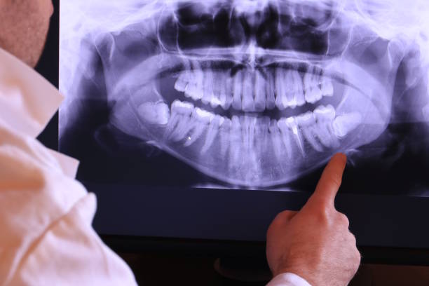 Best Broken or Cracked Tooth Emergency Dentist in El Cerro Mission, NM