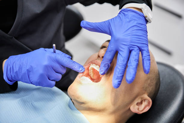 Best Emergency Dentist for Lost Fillings or Crowns in El Cerro Mission, NM